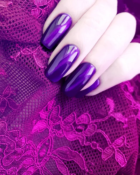 Vrouwelijke Handen Manicure Lace — Stockfoto