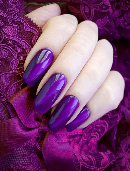 Vrouwelijke Handen Manicure Lace — Stockfoto