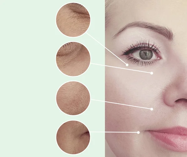 Woman Wrinkles Correction Procedures Collage — Stock Photo, Image