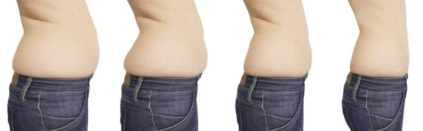 Barriga Mulher Antes Depois Perda Peso — Fotografia de Stock