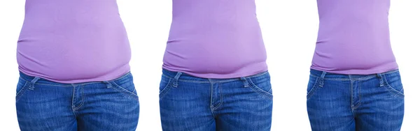 Vientre Mujer Antes Después Pérdida Peso Deportes — Foto de Stock