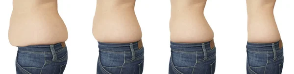 Frauen Bauch Schlankheitskur Vor Und Nach — Stockfoto
