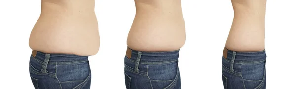 前後に痩せている女性の腹 — ストック写真