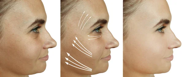 Woman Face Wrinkles Treatment Collage — Stock Photo, Image