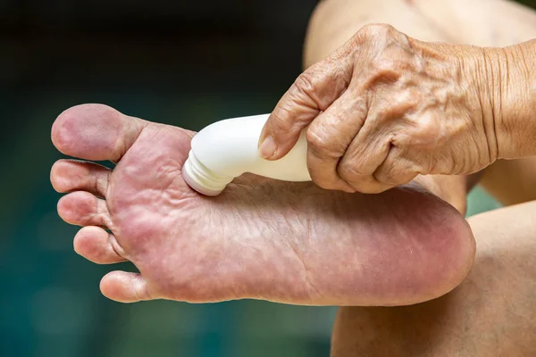 Mano della donna anziana utilizzando liquido analgesico, rullo antidolorifico muscolare sul piede, sfondo della piscina blu, parte asiatica della pelle del corpo, Circa il massaggio, concetto di assistenza sanitaria — Foto Stock