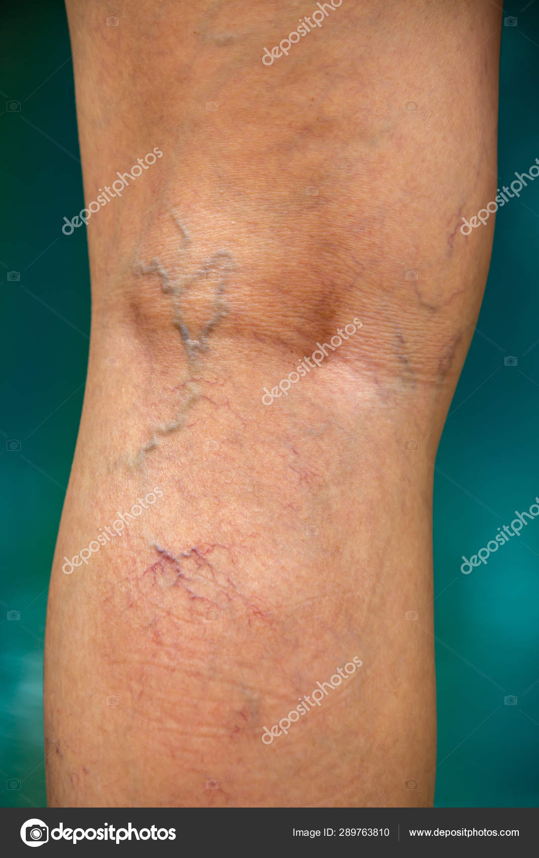 parte posterior de la rodilla
