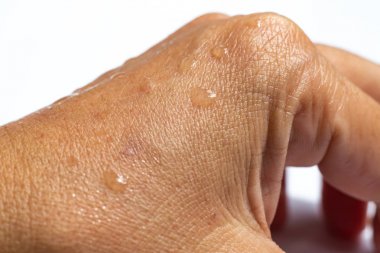 Beyaz akrilik arka planda su damlaları ile kadın ıslak arka el, yakın çekim & makro Shot, seçici odak, Asya vücut cilt parçası, rahatlatıcı banyo, sağlık konsepti