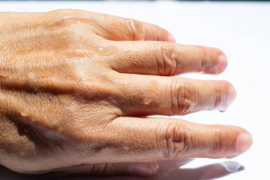 Beyaz akrilik arka planda su damlaları ile kadın ıslak arka el, yakın çekim & makro Shot, seçici odak, Asya vücut cilt parçası, rahatlatıcı banyo, sağlık konsepti