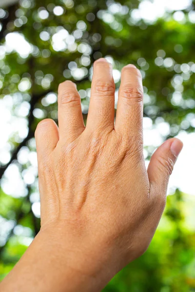 Acionador Finger lock no dedo mindinho da mão esquerda da mulher, Sofrendo de dor, em fundo jardim verde bokeh, Close up & Macro tiro, síndrome de escritório, conceito de cuidados de saúde — Fotografia de Stock