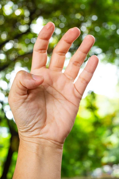 Trigger Finger lock on thumb finger of woman's front left hand, Suffering from pain, in bokeh green garden background, Close up & Macro shot, Office syndrome, Health care concept — Stock Photo, Image