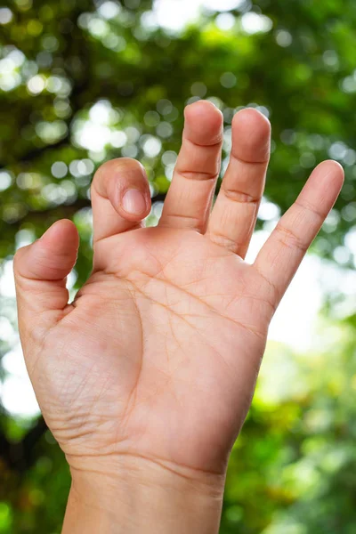 Trigger Finger lock su pollice e indice della mano sinistra anteriore della donna, Sofferenza di dolore, in bokeh verde giardino sfondo, Close up & Macro shot, Sindrome di Office, Concetto di assistenza sanitaria — Foto Stock