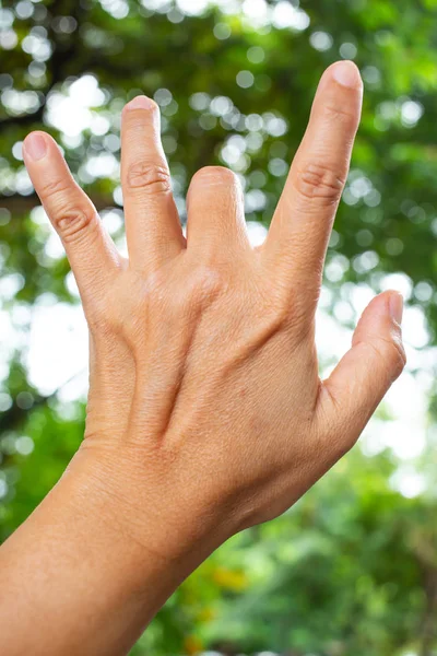 Trigger Finger zár a középső ujját a nő vissza bal kezét, szenved a fájdalomtól, a bokeh zöld kert háttérben, Close Up reggeli makró, Office-szindróma, egészségügyi koncepció — Stock Fotó