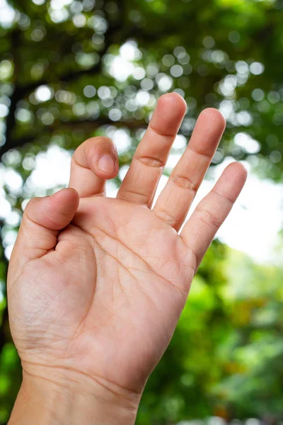 Tetik parmak kilit başparmak ve kadın ön sol elin parmak kilidi, ağrı muzdarip, bokeh yeşil bahçe arka plan, yakın çekim & makro Shot, ofis sendromu, sağlık kavramı