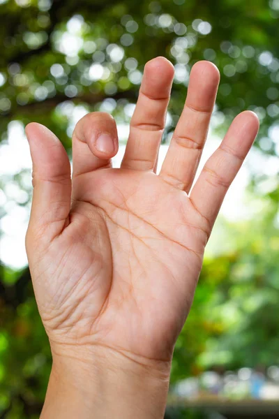 Trigger Finger lock on index finger of woman\'s front left hand, Suffering from pain, in bokeh green garden background, Close up & Macro shot, Office syndrome, Health care concept