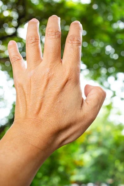 Trigger Finger lock on thumb finger of woman's back left hand, Suffering from pain, in bokeh green garden background, Close up & Macro shot, Office syndrome, Health care concept — Stock Image Trigger Finger lock on thumb finger of woman's back left hand, Suffering from pain, in bokeh green garden background, Close up & Macro shot, Office syndrome, Health care concept Royalty Free Stock Photos