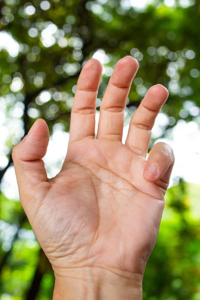 Trigger Finger lock on little finger of woman's front left hand, Suffering from pain, in bokeh green garden background, Close up & Macro shot, Office syndrome, Health care concept — Stock Image Trigger Finger lock on little finger of woman's front left hand, Suffering from pain, in bokeh green garden background, Close up & Macro shot, Office syndrome, Health care concept Royalty Free Stock Images