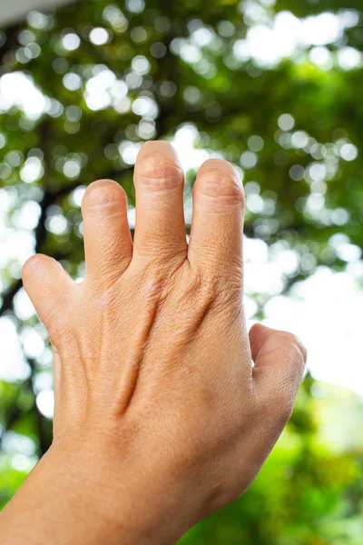 Trigger Finger lock on fingers of woman's back left hand, Suffering from pain, in bokeh green garden background, Close up & Macro shot, Office syndrome, Health care concept — Stock Image Trigger Finger lock on fingers of woman's back left hand, Suffering from pain, in bokeh green garden background, Close up & Macro shot, Office syndrome, Health care concept Stock Photo