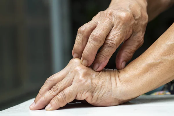 Mano derecha de la mujer mayor rasguñándose la mano izquierda, Sobre fondo blanco de la mesa, Primer plano, Parte asiática de la piel del cuerpo, Concepto de salud — Foto de Stock
