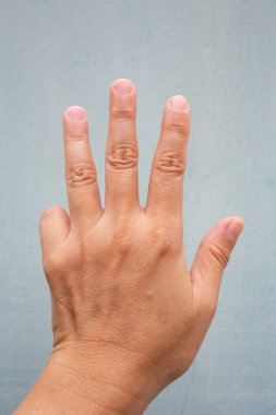 Tetik Parmak kilit kadının ön sol elinin küçük parmağında, Ağrı muzdarip, Mavi-gri renk arka plan, Close up & Macro shot, Office sendromu, Sağlık kavramı