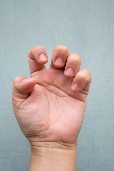 Acionador Bloqueio do dedo nos dedos da mão esquerda frontal da mulher, Sofrendo de dor, No fundo de cor azul-cinza, Close up & Macro shot, Síndrome de escritório, Conceito de cuidados de saúde — Fotografia de Stock