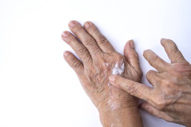 Kıdemli Kadın beyaz arka plan izole ellerine nemlendirici krem uygulayarak, Asya vücut cilt parçası, Güzellik kavramı
