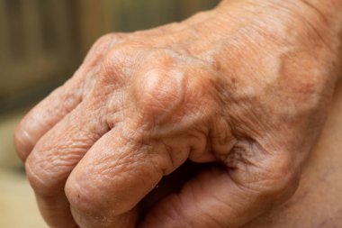 Elin arka kısmında kan kıdemli kadının kırışık cilt dokusu, Close up & Macro shot, Seçici odak, Asya vücut cilt parçası, Sağlık kavramı
