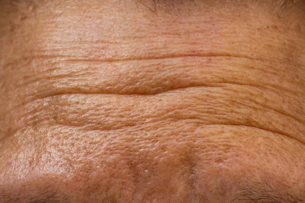 Senior woman\'s wrinkled forehead, Close up & Macro shot, Selective focus, Light & Shadow, Body part, Healthcare concept