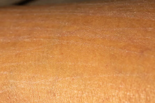 Kobieta zarysowania i suchość skóry na nogę, zbliżenie & makro strzał, Asian Body skóry część, koncepcja opieki zdrowotnej, streszczenie tło — Zdjęcie stockowe