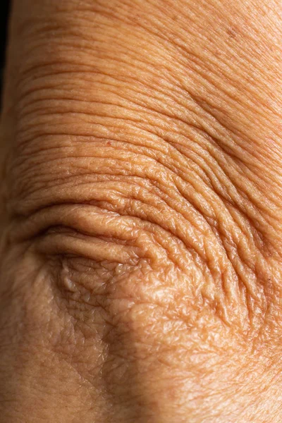 Senior kvinnans skrynkliga armbåge, närbild & Macro Shot, selektiv fokus, asiatisk kropp hud koncept, abstrakt bakgrund — Stockfoto