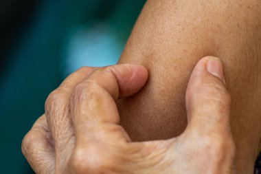 Senior Woman sol elini sağ kolunu kaşıyarak, Mavi yüzme havuzu arka plan, Çekim kadar kapat, Asya Vücut cilt parçası, Sağlık kavramı