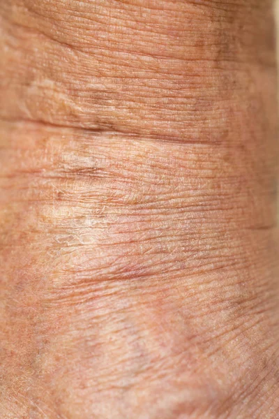 Senior Woman ' s torra och skrynkliga handled i armen, närbild & Macro Shot, selektiv fokus, Asiatisk kropps hud del, sjukvård koncept, abstrakt bakgrund — Stockfoto