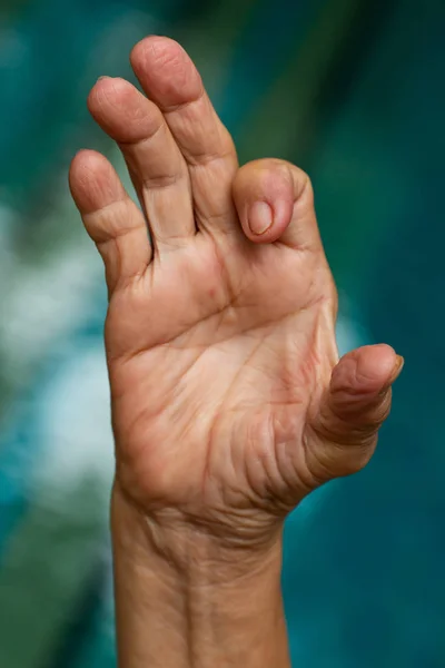 Trigger Finger lock on index finger of senior woman's right hand, Suffering from pain, Swimming pool background, Health care concept — Stock Photo, Image