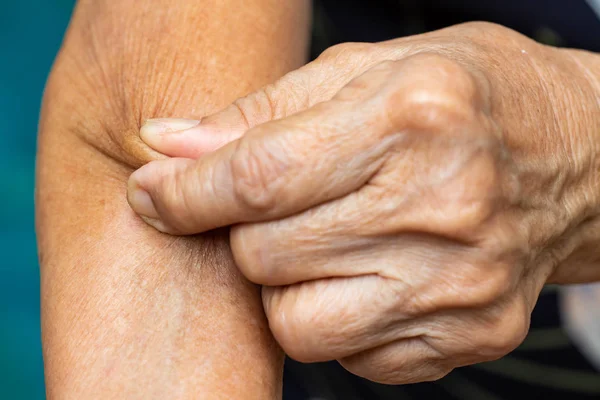 Senior vrouw linkerhand knijpen haar rechterarm, blauwe zwembad achtergrond, close-up shot, Aziatische lichaam huid deel, gezondheidszorg concept — Stockfoto