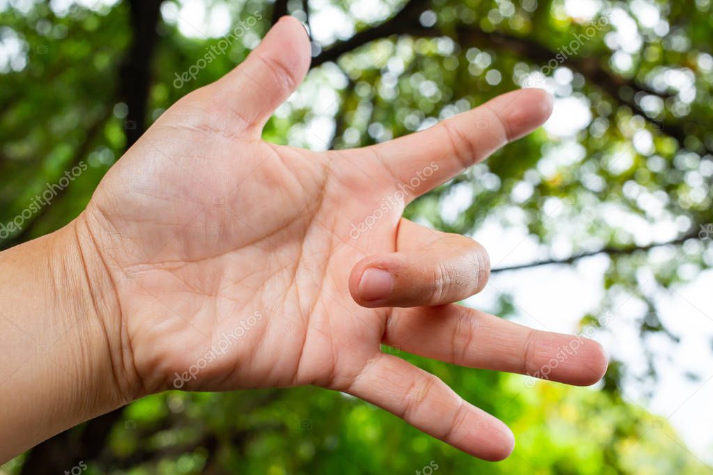 Trigger Finger lock on middle finger of woman's left hand, Suffering from pain, Bokeh green garden background, Health care concept