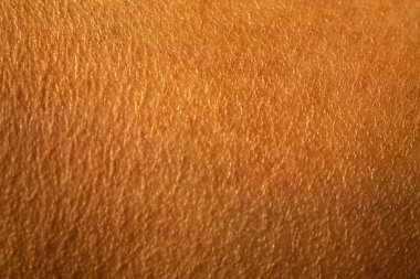 Bacakta kadının kuru cildi, Yakın çekim & Makro çekim, Asya Vücut cilt parçası, Sağlık kavramı, Soyut arka plan