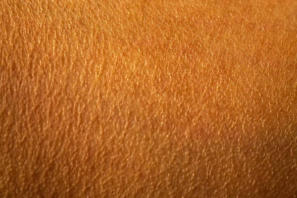 Το ξηρό δέρμα της γυναίκας στο πόδι, κοντινό πλάνο και shot, ασιατικό τμήμα δέρματος, έννοια της υγειονομικής περίθαλψης, αφηρημένο φόντο — Φωτογραφία Αρχείου