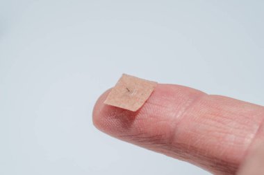 Geleneksel Çin ilaç tedavisinde kullanılan küçük bir baskı iğnesi (deri içi iğne) uygulamaya hazırlanan bir parmak.