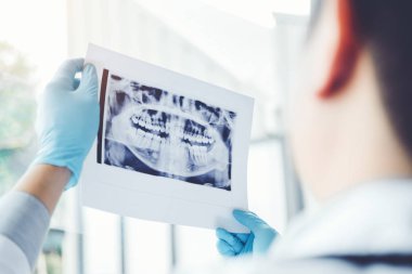 Dentist consulting with patient presenting results on Dental x-ray film About the problem of the patient clipart