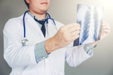 Holding ve göğüs röntgen filmi veya ward hastanede röntgen görüntü denetimi doktor