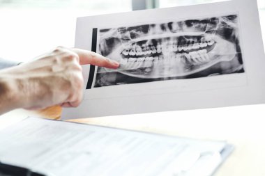 Erkek hastaya konuşuyor ve sonuçlarını diş üzerinde sunan diş hekimi