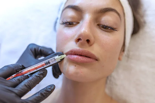 Process of lips filler injection procedure