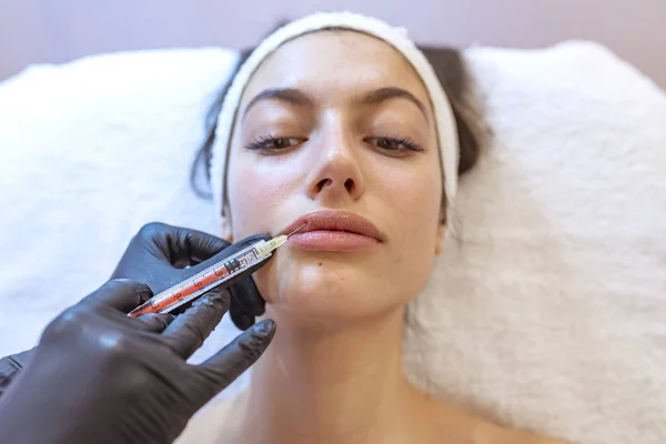 Process of lips filler injection procedure