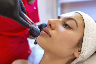 Dudak dolgu enjeksiyon prosedürü yakın çekim  