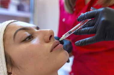 Dudak dolgu enjeksiyon prosedürü yakın çekim  