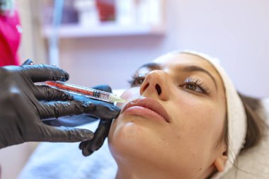 Dudak dolgu enjeksiyon prosedürü yakın çekim  