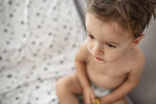 Niño Con Piel Manchada Concepto Médico Niño Con Varicela Mitad —  Fotos de Stock