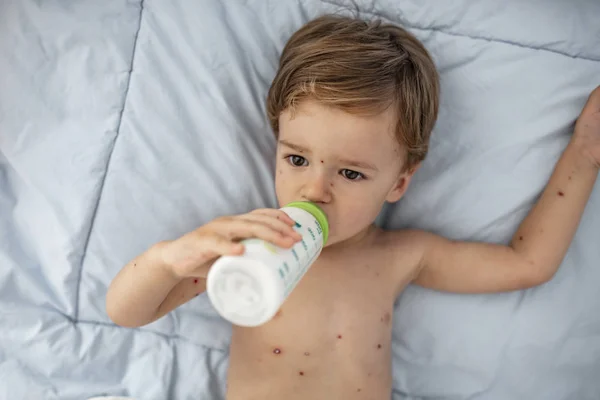 Baby Boy Bárányhimlő Fogyasztói Tej Bottle Baby Iszik Tejet Míg — Stock Fotó