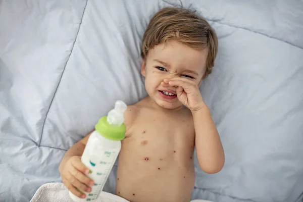 Kisgyermek Fiú Bárányhimlő Fogyasztói Tejet Egy Üveg Takaró Baby Boy — Stock Fotó