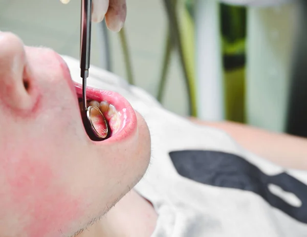 Paciente en el consultorio de dentistas, consiguiendo sus dientes blancos espacios interdentales examinados con espejo de mano para el sarro y la placa. Higiene dental, procedimientos dolorosos y concepto de prevención . — Foto de Stock