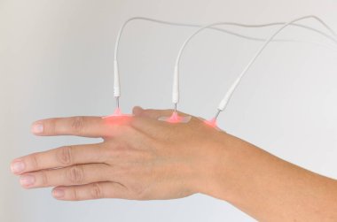 Woman having EMS or electrical Muscle Stimulation on her hand with attached therapeutical electrodes isolated over white clipart